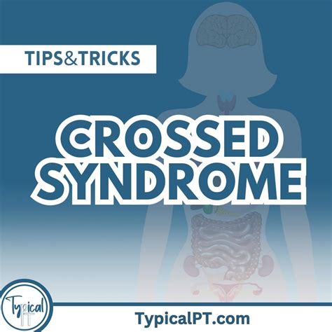 NPTE TIPS : r/PTschool .